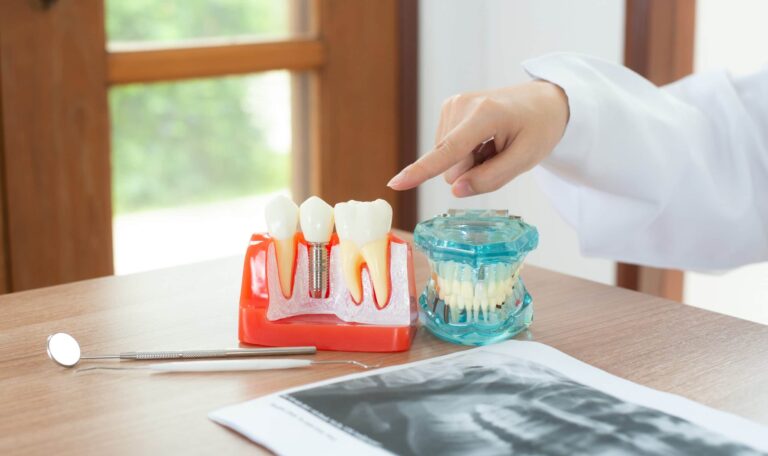 dentist-with-dental-implant-model-2021-08-29-01-04-50-utc-scaled-1